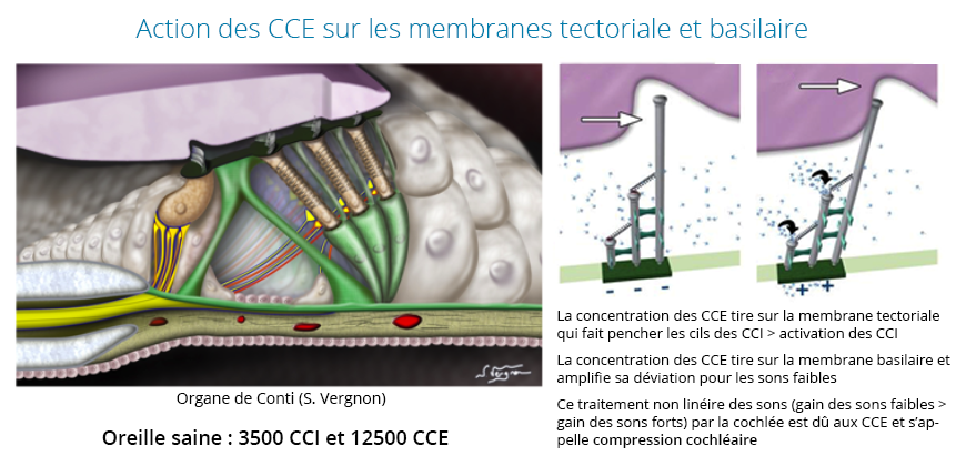 cause acouphènes : action CCE sur membranes tectoriale et basilaire