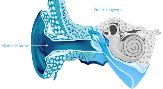 Surdité de transmission problème oreille externe ou oreille moyenne