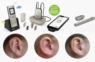 choix appareils auditifs